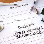 there are various treatments for deep vein thrombosis, all of which depend on the severity of the condition. Anticoagulant medications are often used to prevent new clots and help dissolve existing ones.