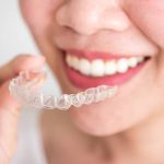 benefits of invisalign