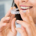 how long does it take for invisalign to work