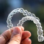 Aligners in the hand